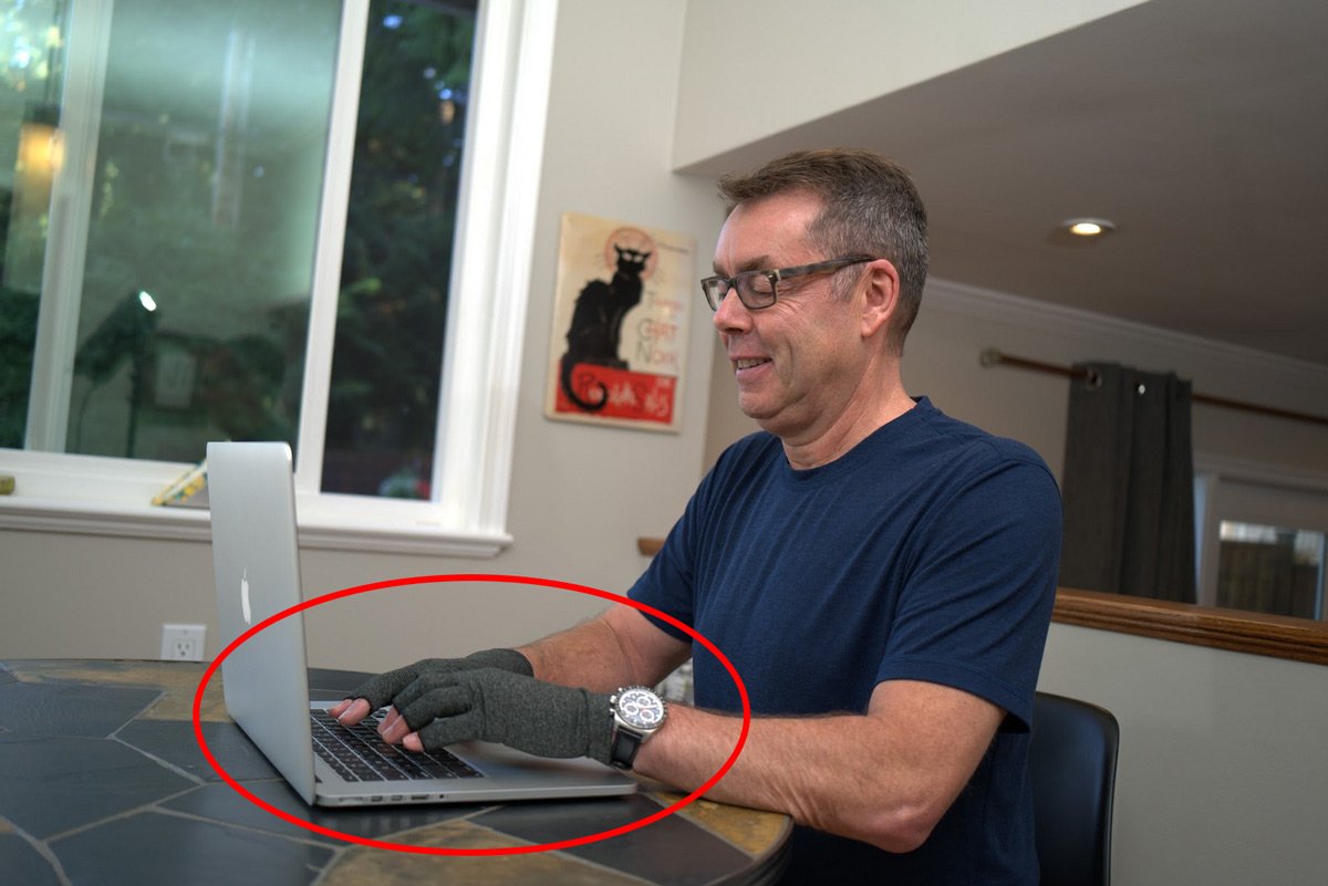 ArthritisGloves